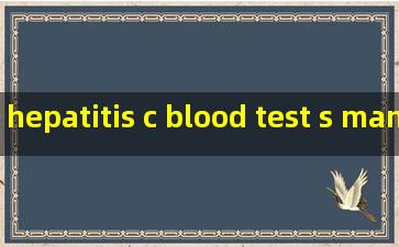hepatitis c blood test s manufacturer
